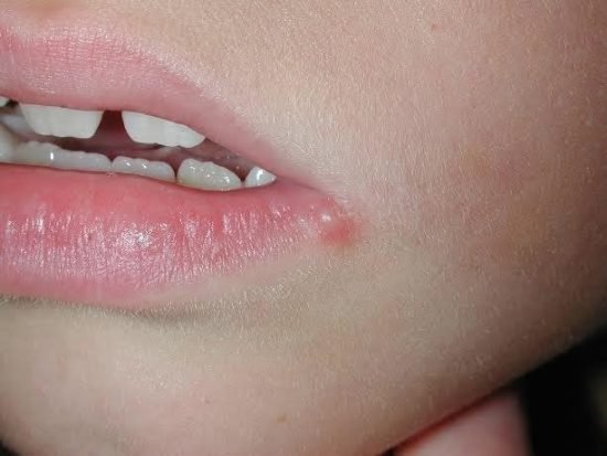 Hình ảnh bài viết