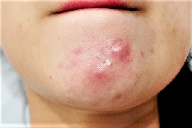 Hình ảnh bài viết